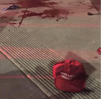 The case of a sword attack, a MAGA hat and a bloody photo posted on social media
