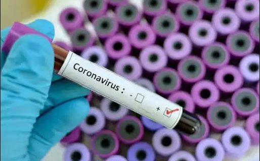 Report: First coronavirus death in U.S. occurred weeks earlier than thought Report: First coronavirus death in U.S. occurred weeks earlier than thought