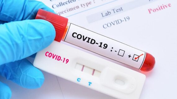 Reports: More than 100 illegals released by Biden into U.S. test positive for covid Reports: More than 100 illegals released by Biden into U.S. test positive for covid