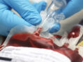 Studies raise concerns on safety of blood transfusions affected by Covid-era policies